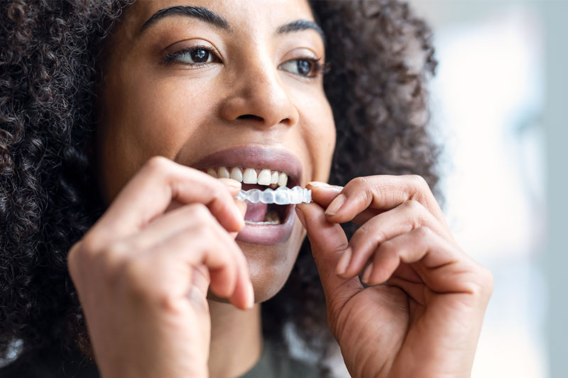 Clear Aligner Therapy in Sicklerville